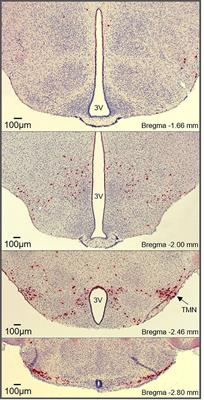 Histaminergic regulation of food intake